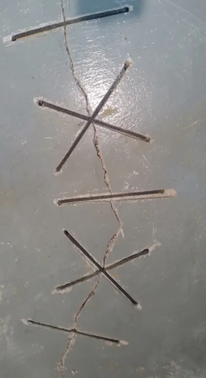 Stitches